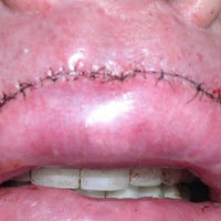 Punkinloveee - Plastic загрузить